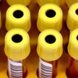HIV testing HIV testing